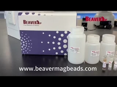 BeaverBeads evacua a estabilidade de Kit Extract Nucleic Acid Excellent do RNA